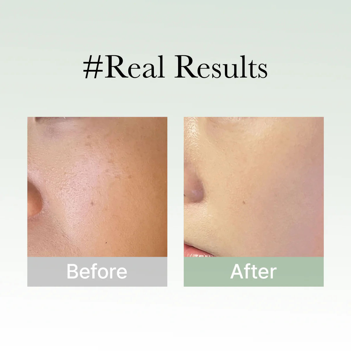 Arencia Holy Hyssop Serum